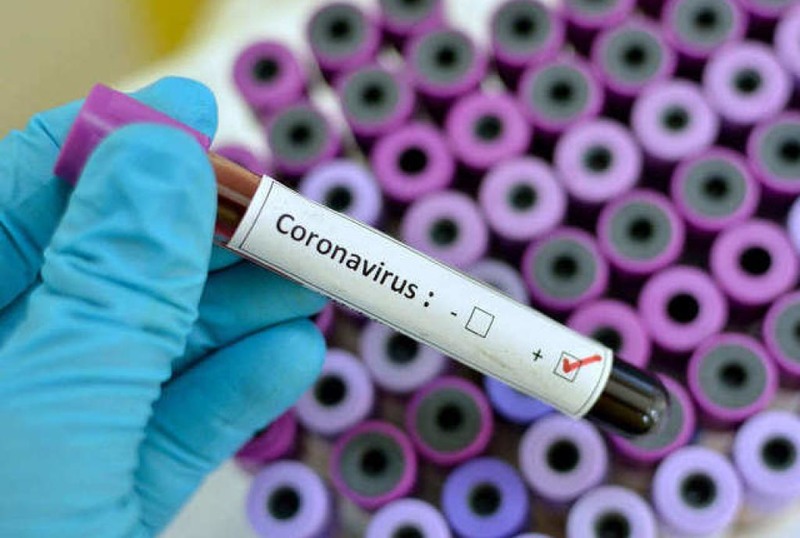 На Херсонщині у п’яти лікарнях проводитимуть тестування на COVID-19 методом ІФА