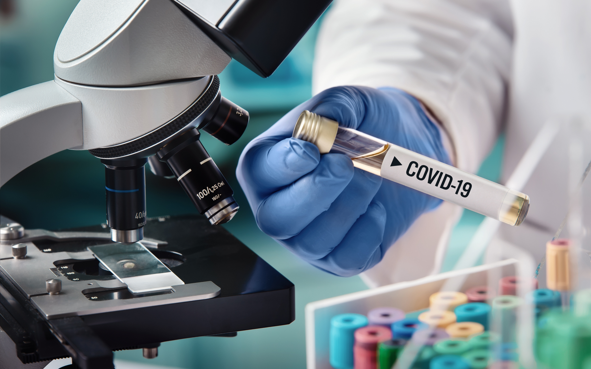 На Херсонщині за добу COVID-19 підтвердили у 193-х людей, померли - 3
